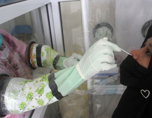 Hati-hati, Virus Corona Bisa Timbulkan Reaksi seperti Alergi