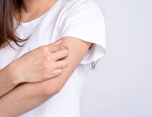 9 Penyebab Biduran Kronis yang Tak Kunjung Sembuh