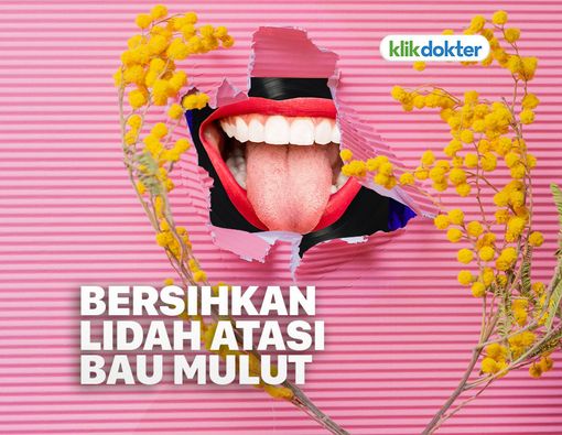 Membersihkan Lidah Bisa Atasi Bau Mulut, Benarkah?