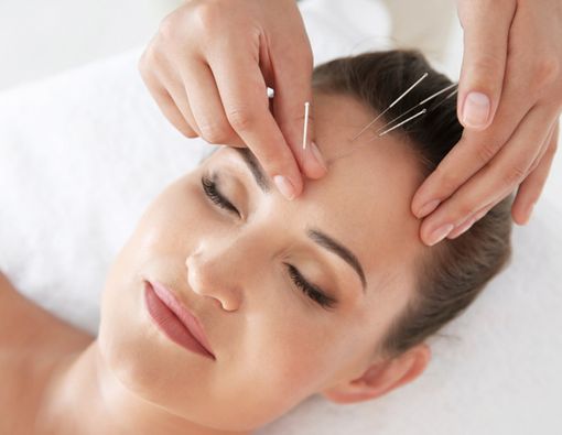 Benarkah Pengobatan Akupunktur Bisa Atasi Insomnia?