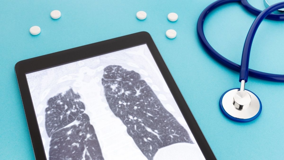 Perawatan untuk Penderita Penyakit Paru Restriktif