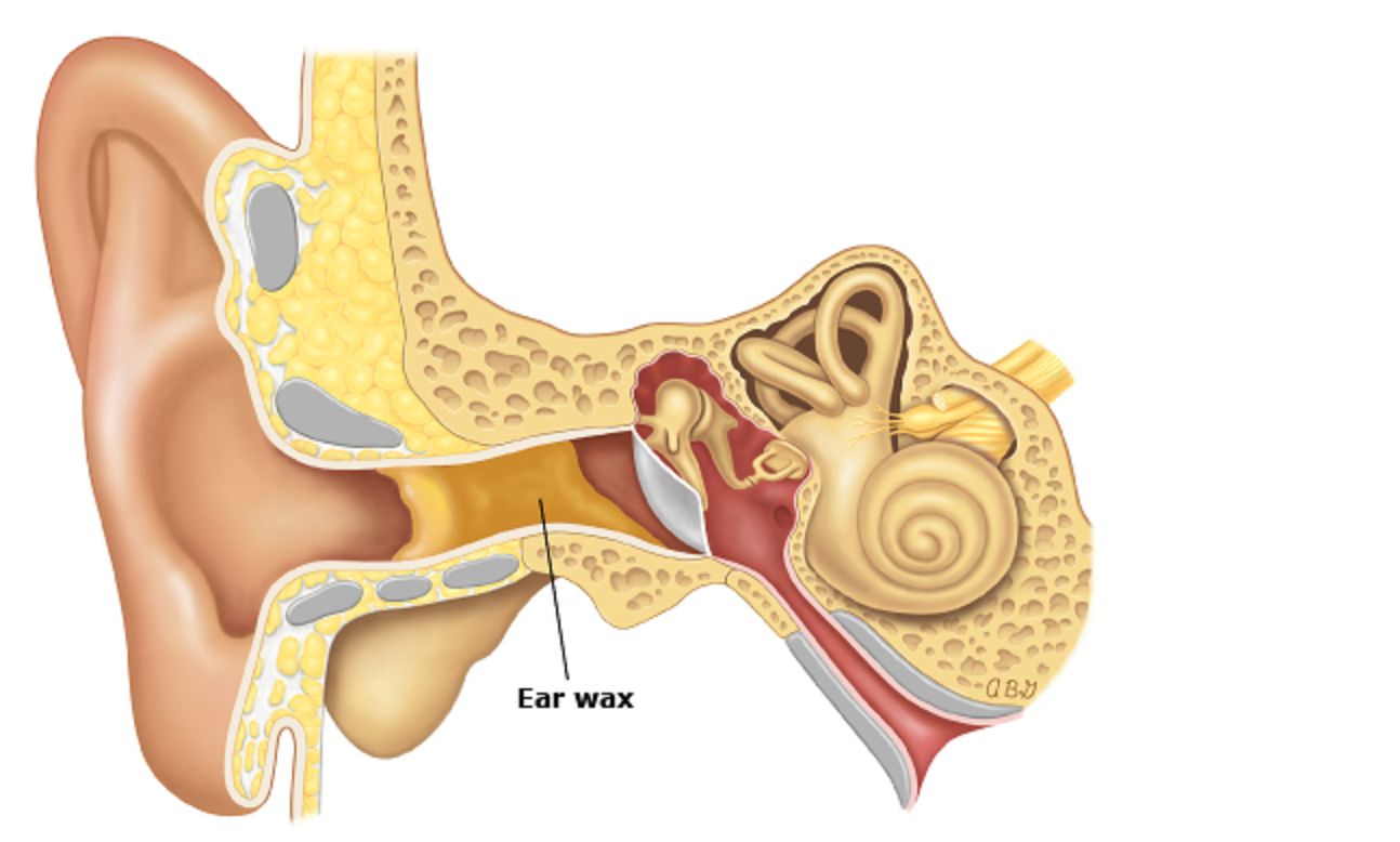 5 Ciri Anda Memiliki Telinga Bermasalah