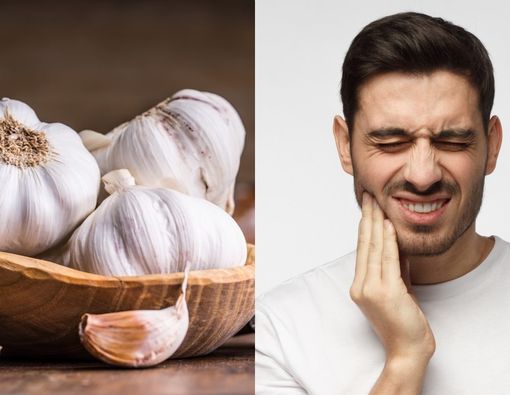 Mau Atasi Sakit Gigi dengan Bawang Putih, Cek Dulu Efektivitasnya