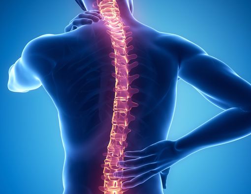 7 Tipe Skoliosis dan Penyebabnya