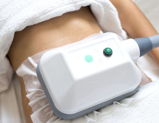 Jelang Nikah, Pacar Caesar Hito Lakukan Pembekuan Lemak, Apa Itu?