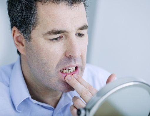 Kenali Rasa Ngilu yang Bukan Diakibatkan Gigi Sensitif