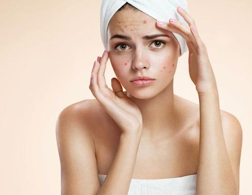 Tips Merawat Wajah untuk Kulit Sensitif