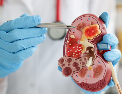 Fungsi Enzim Renin dan Masalah Kesehatan yang Memengaruhinya