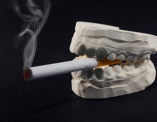 6 Kebiasaan yang Dapat Merusak Gigi