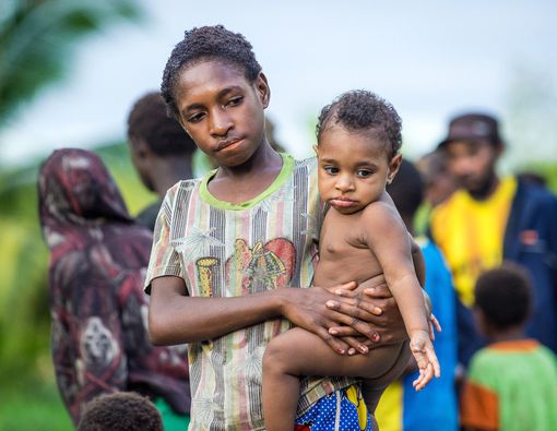 Kenali Gejala Campak yang Kini Mewabah di Asmat
