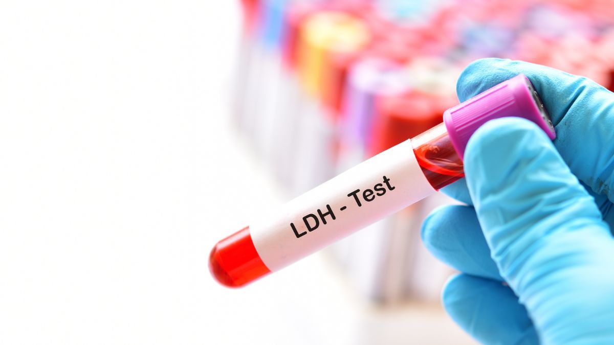 Pemeriksaan LDH: Fungsi, Manfaat, dan Hasil Normalnya