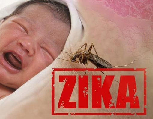 Bayi yang Terinfeksi Virus Zika Dapat Mengalami Kerusakan Mata