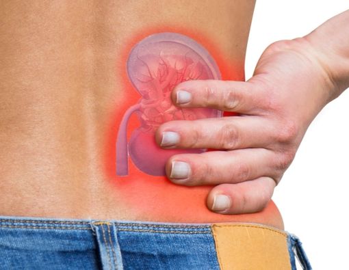 Mengenal Ciri dan Gejala Ruptur Ginjal yang Mesti Diwaspadai