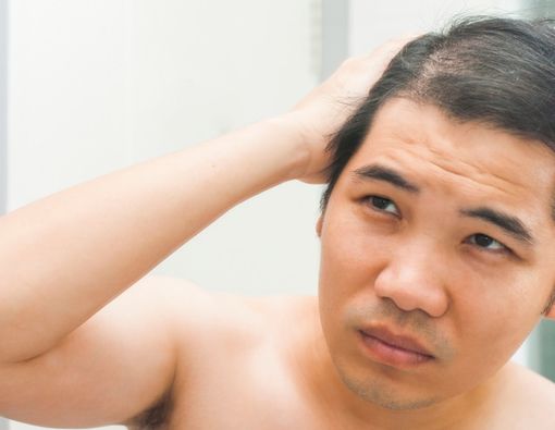 Cara Alami Menghilangkan Koreng di Kulit Kepala