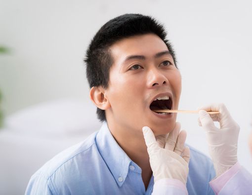 Inilah Ciri Lidah Penderita HIV yang Patut Diwaspadai