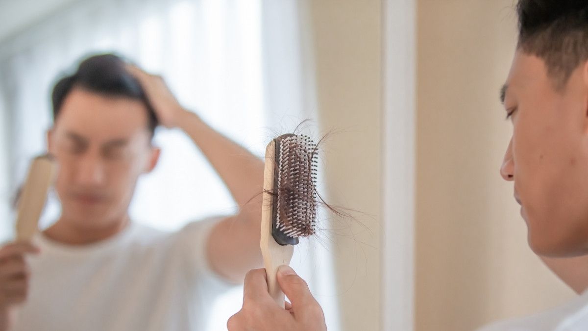 Kekurangan Sederet Nutrisi Ini Bisa Picu Kerontokan Rambut