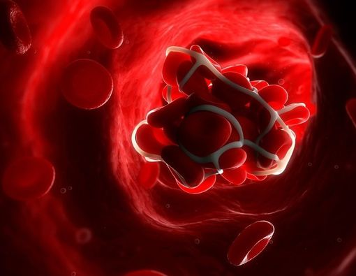 Mengenal Proses Pembekuan Darah atau Koagulasi