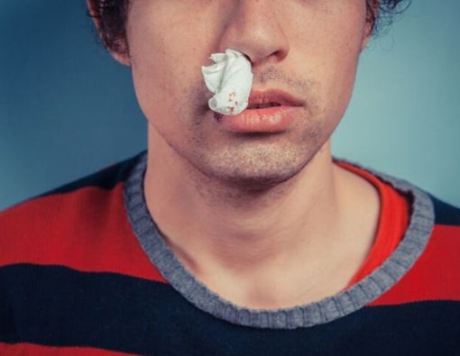 Tak Perlu Panik, Kenali Penyebab Hidung Berdarah