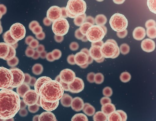 Awas, 5 Kebiasaan Ini Tingkatkan Risiko Kanker!