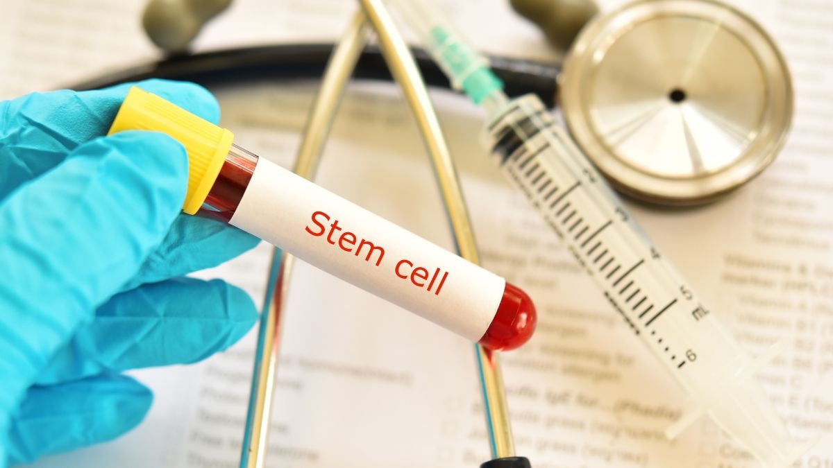 Perbedaan dan Contoh Penerapan Exosome, Secretome, dan Stem Cell