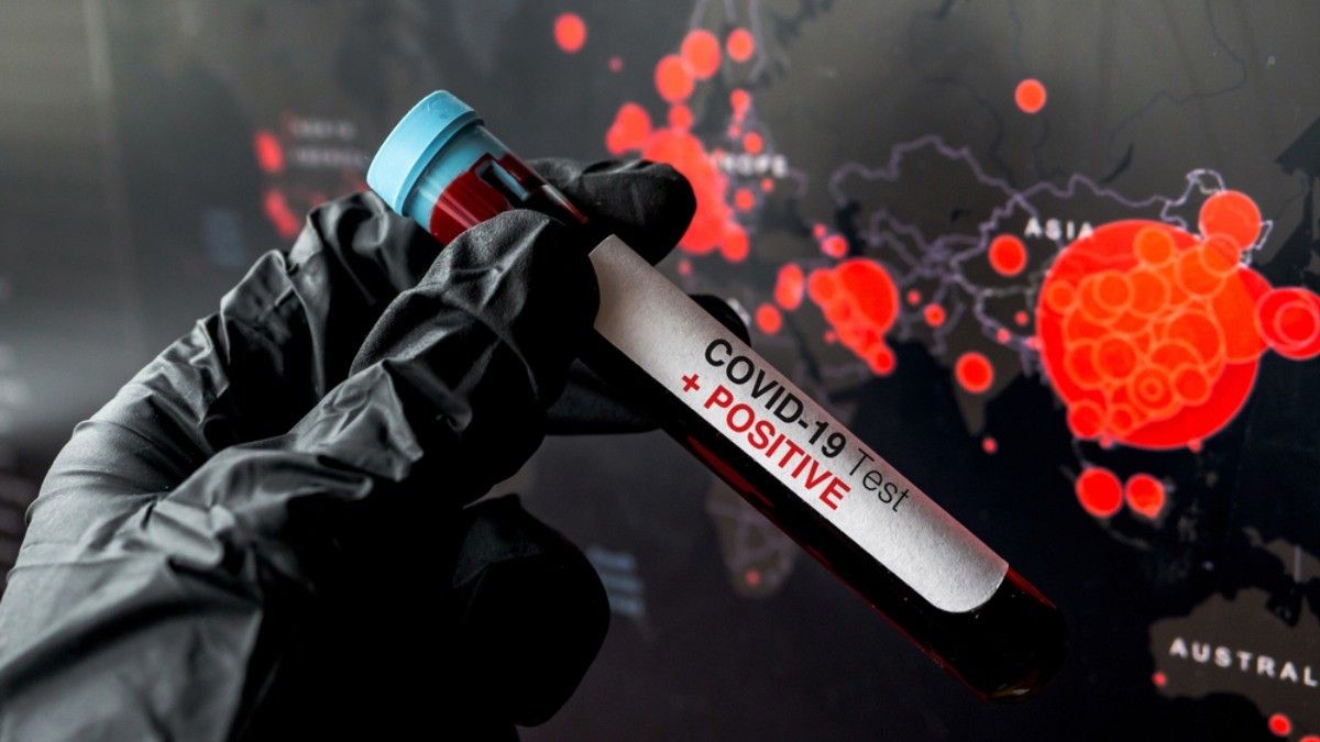 Takut Salah Sangka, Hindari Bandingkan Kasus Coronavirus di Negara Lain