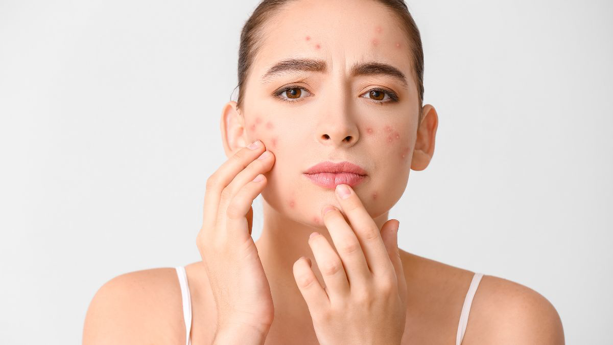 Ciri Sunscreen Tidak Cocok