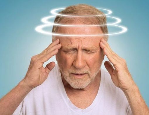 Jenis-Jenis Sakit Kepala yang Perlu Diketahui