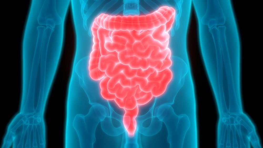 Apakah Tifus Bisa Picu Kanker Usus?