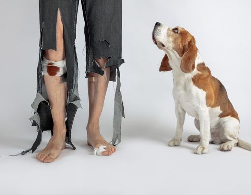 Rabies, Tak Hanya karena Gigitan Anjing