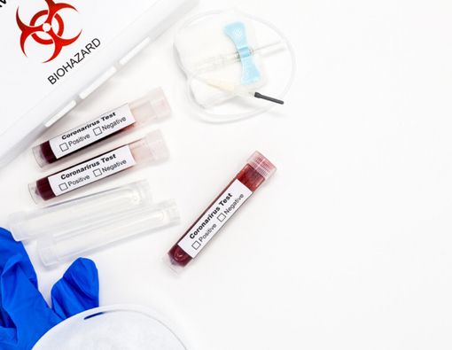 Dijual Online, Benarkah Alat Tes Virus Corona Instan Bisa Digunakan?