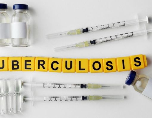 WHO: Kematian Penderita TBC Meningkat Drastis selama Pandemi