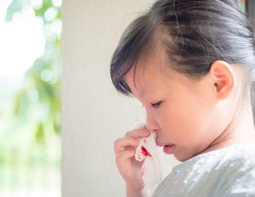 Pertolongan Pertama Saat Anak Mimisan