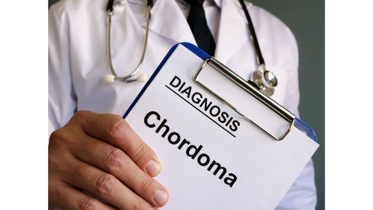 Mengenal Jenis Chordoma, Kanker Langka di Tulang Belakang