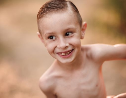 Dampak Malnutrisi Terhadap Pertumbuhan Anak