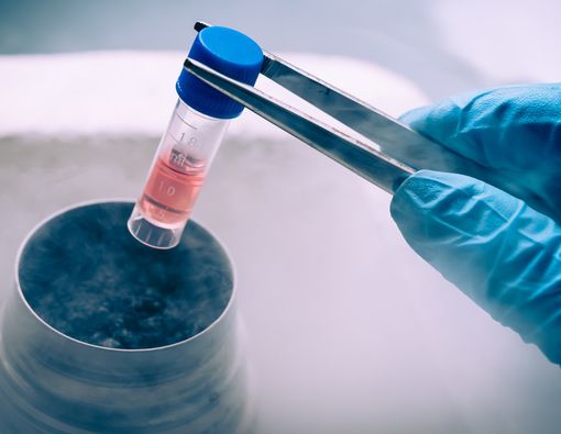 Mengenal Terapi Stem Cell dan Potensinya untuk Menyembuhkan Penyakit Berat