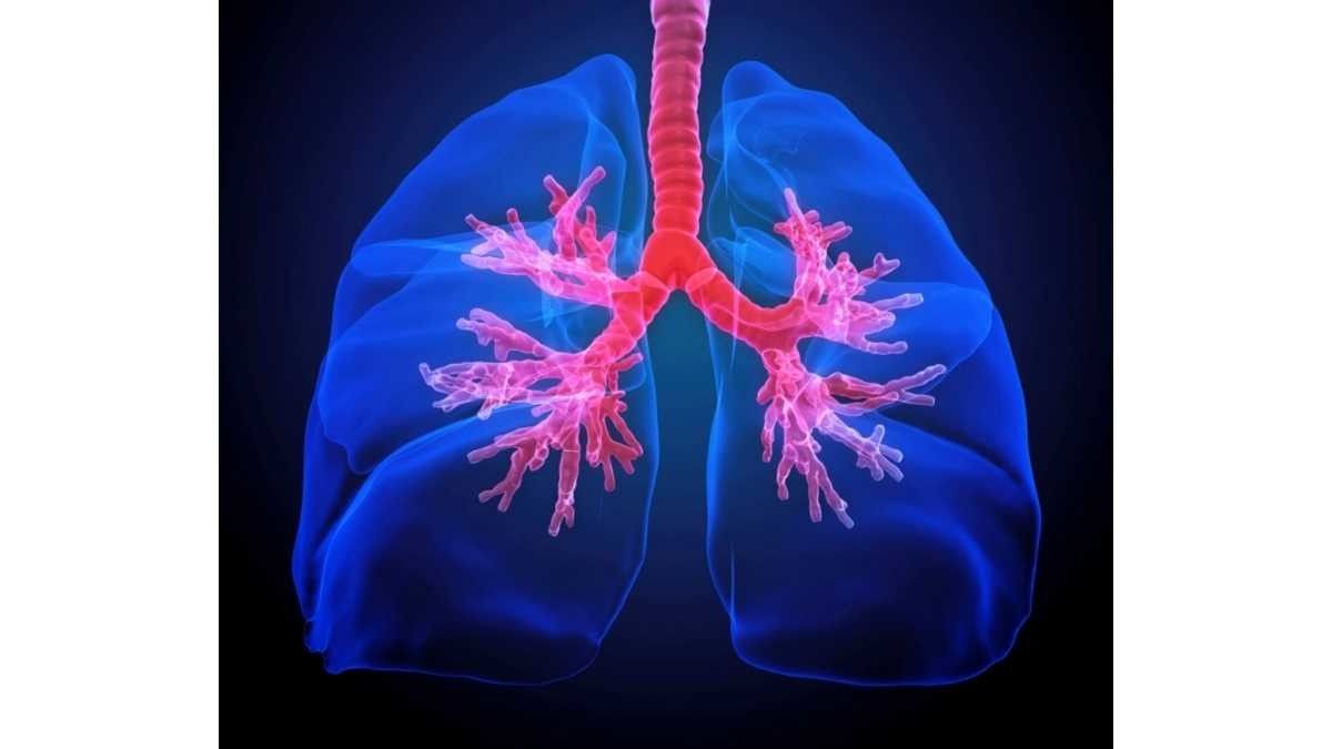 Waspada, Fibrosis Paru Tingkatkan Risiko Gangguan Jantung