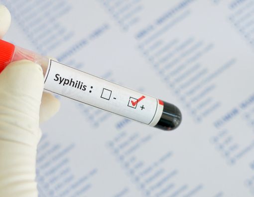 Sifilis