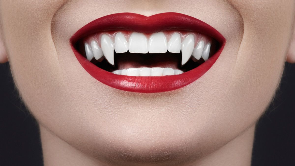 Gigi Taring Mirip Drakula, Perlukah Lakukan Potong Gigi?