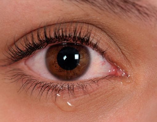 Mata Terus Berair, Kapan Anda Perlu Khawatir?