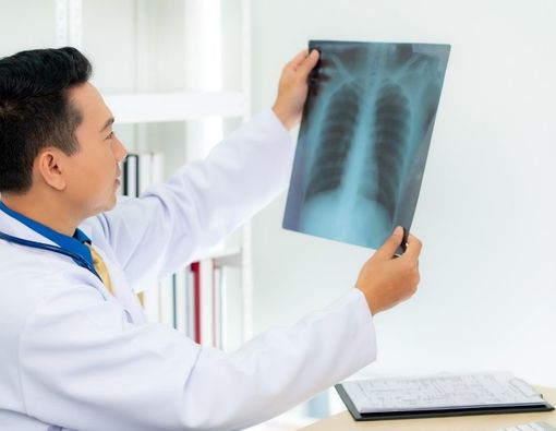 Kenali Kondisi Hemothorax, Penumpukan Darah di Paru-paru