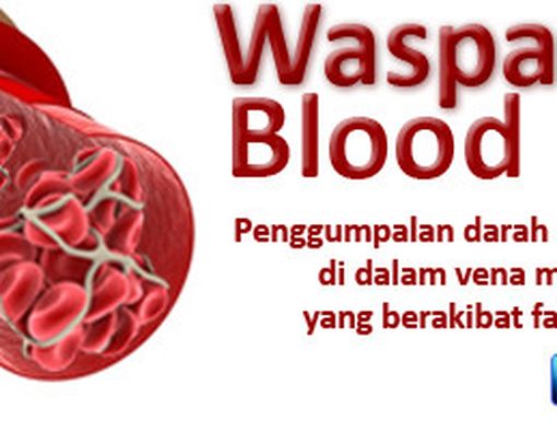 Waspadai Gumpalan Darah