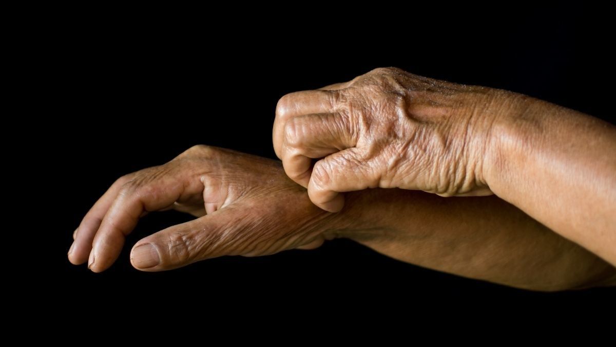 Fakta Penyakit Psoriasis Pada Orang Berkulit Gelap