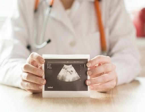 Jenis-jenis USG pada Kehamilan