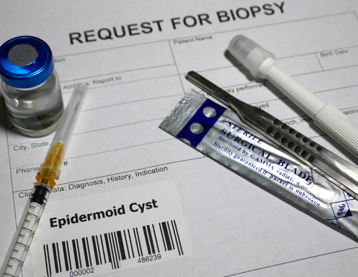 Mengenal Biopsi Eksisi, Tujuan, Manfaat, dan Prosedurnya