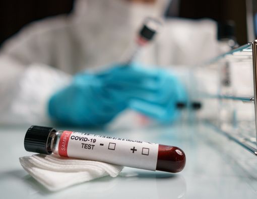 Riset: Ada Orang Kebal Terhadap COVID-19, Kok Bisa?