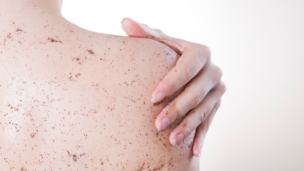 Peeling Skin Syndrome, Penyakit Langka Penyebab Kulit Terkelupas