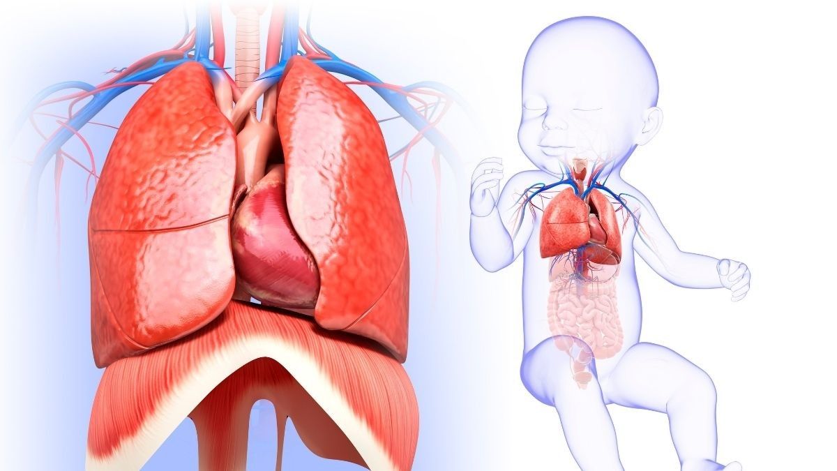 Kenali dan Waspadai Bronchopulmonary Dysplasia pada Bayi