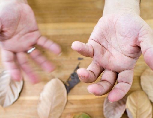 Diabetes Tipe 2 dan Hubungannya dengan Penyakit Parkinson