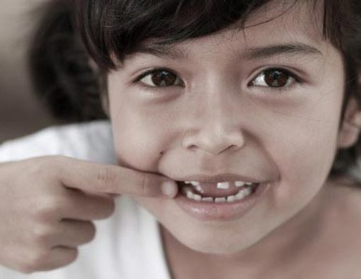 Gigi Si Kecil Patah, Harus Bagaimana?