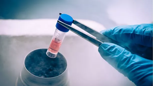 Stem Cell Berpotensi Jadi Pengobatan Diabetes